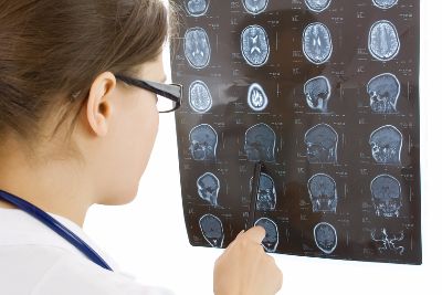 brain injury