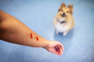 Can Landlords be Held Liable for Bite Injuries from a Tenants Dog?