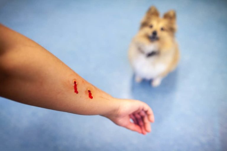 will my renters insurance cover a dog bite